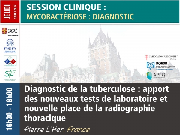 Diagnostic de la tuberculose : apport des nouveaux tests de laboratoire et nouvelle place de la radiographie thoracique
