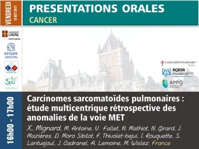 Carcinomes sarcomatoïdes pulmonaires : étude multicentrique rétrospective des anomalies de la voie ME